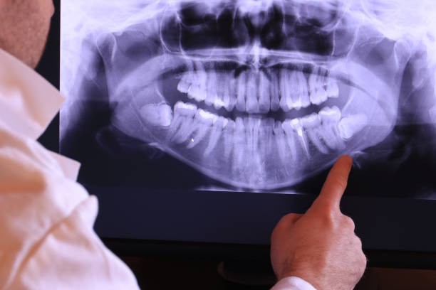 Best Same-Day Emergency Dentist in Mount Hore, WI